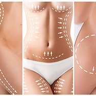 Liposuccion - Liposculpture