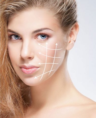 1_fillers injection dacide hyaluronique Geneve